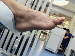 -Andrew指甲专科灰指甲·甲沟炎矫正·3D步态矫形鞋垫定制(上海法华镇路旗舰店)