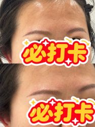 点击看大图 -张小野·专业半永久纹眉