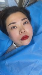 点击看大图 体验后-重庆联合丽格第五医疗美容医院