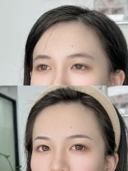 点击看大图 -张小野·专业半永久纹眉