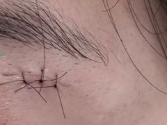 -上海市皮肤病医院(武夷路院区)