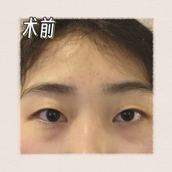 -素美医疗美容·西南眼鼻整形·修复基地