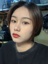 点击看大图 体验后-深圳阳光医疗美容医院·旗舰店