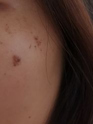 -小忠丽格医美