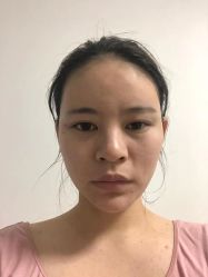 -广东韩妃整形外科医院