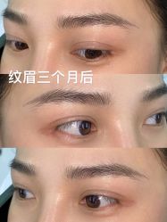 点击看大图 -OnFaer.纹眉半永久无创洗眉
