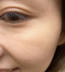 -美莱医学美容医院