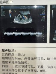 -上海百佳妇产医院