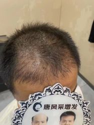 -唐风采假发补发定制