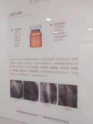点击看大图 -熙朵美学植发连锁