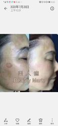 -美人痣全国连锁