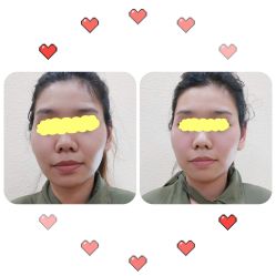 -颜和骨正·明哲式骨相美学整骨