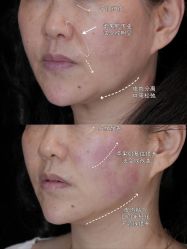 -Yestar重庆艺星医疗美容医院