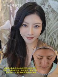 -北京米扬丽格医疗美容·联合丽格鼻整形中心