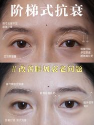 -克丽缇娜