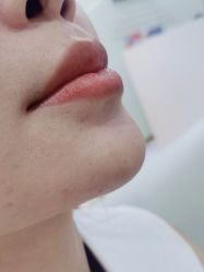 -广州美莱医疗美容医院