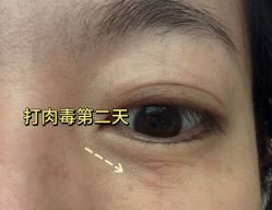-青岛诺德医学美容医院