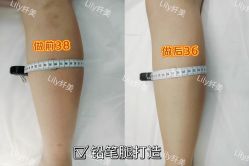 -Lily纤美·科技减脂中心