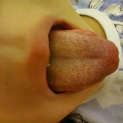 -莘苗家小儿推拿(印象城店)