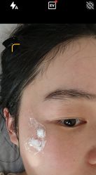 体验前-上海首尔丽格医疗美容医院
