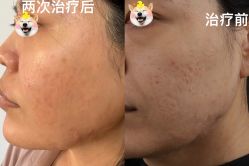 -北京楚诺医疗美容