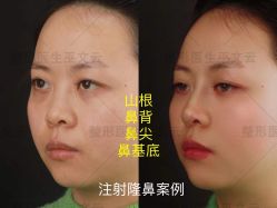 -北京米扬丽格医疗美容·联合丽格鼻整形中心