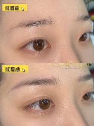 点击看大图 -OnFaer.纹眉半永久无创洗眉