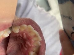 -宁波壹加壹口腔·矫正种植中心