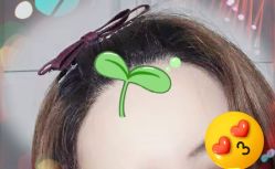 -大麦微针植发全国连锁