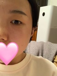 -八大处整形
