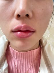 体验后-南京医科大学友谊整形外科医院