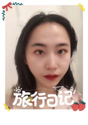 -大麦微针植发全国连锁