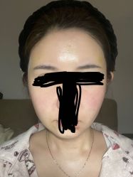 体验后-杭州医巢医疗美容