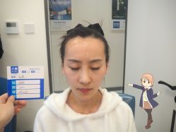 -大麦微针植发丨全国连锁