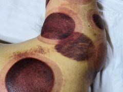 -金桔相云保健按摩中心(同安路商业街店)