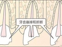 -团圆口腔·种植中心(锦江院区)