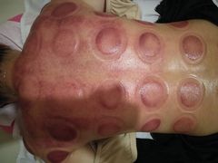 -益友堂盲人推拿正骨穴位按摩工作室