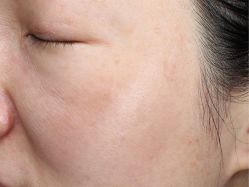 -丽美妍医疗美容·皮秒·立体分层抗衰