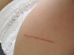 -首都医科大学附属北京潞河医院