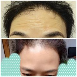 体验后-四川米兰柏羽医学美容医院
