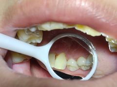 -土豆口腔(凤凰北总店)