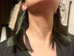 体验后-JS医疗美容