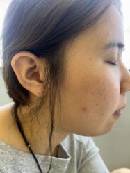 -长沙雅美医疗美容医院