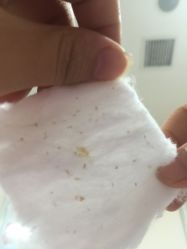 -蕾特恩专业祛痘国际连锁