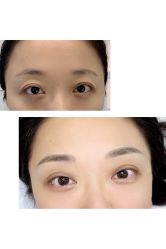 -MIVI半永久纹眉绣眉