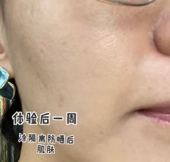 体验后-北京米扬丽格医疗美容·联合丽格鼻整形中心