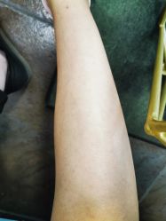 -薇兰专业脱毛连锁机构