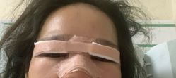 -长沙雅美医疗美容医院