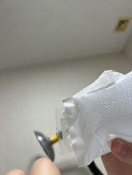 体验后-圣嘉新医疗美容医院