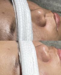 -SKIN79皮肤管理中心